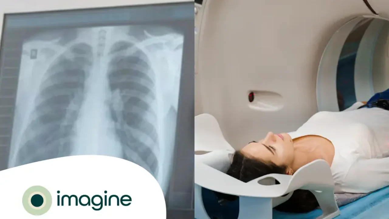 qual-a-diferenca-entre-radiografia-e-tomografia